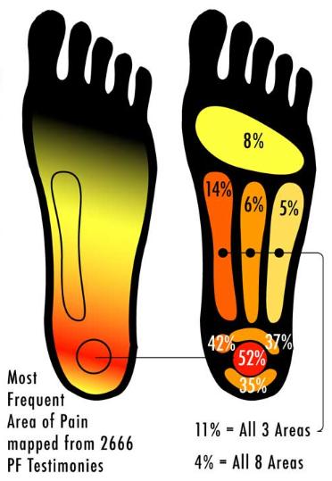heel pain mapping